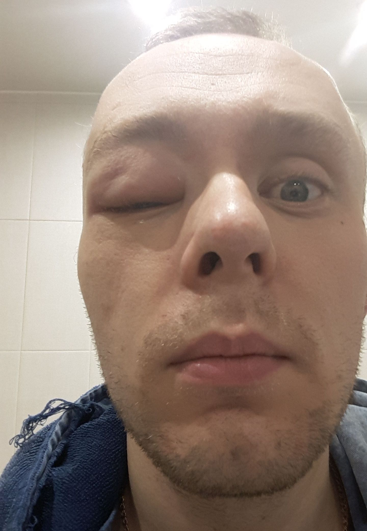 Как я оказался в роли пациента